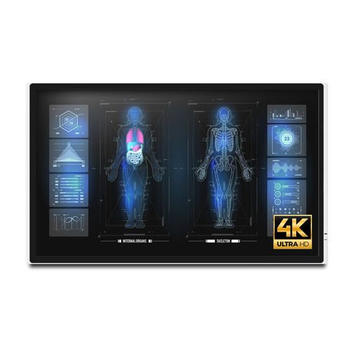 Monitor médico-hospitalar - MEDDP-632 - Onyx Healthcare Inc - com resolução 4K / 32" / LCD