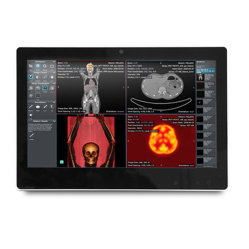 Computador All in One médico Intel® Celeron® - SMA-1533 - Onyx Healthcare Inc - Intel® Atom Dual Core / para serviço de cuidados intensivos / para carrinho de computador