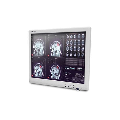 Computador All in One médico Intel® Celeron® - SMA-1733 - Onyx Healthcare Inc - Intel® Atom Dual Core / sem ventilação / com touch screen