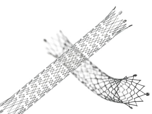 Stent venoso -  E-LUMINEXX® - Bard Medical