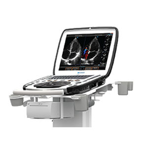 Aparelho de ultrassom móvel - uSmart® 3300 NexGen  - Terason - para anestesia e cuidados intensivos / para emergência médica / para ecocardiograma com estresse farmacológico