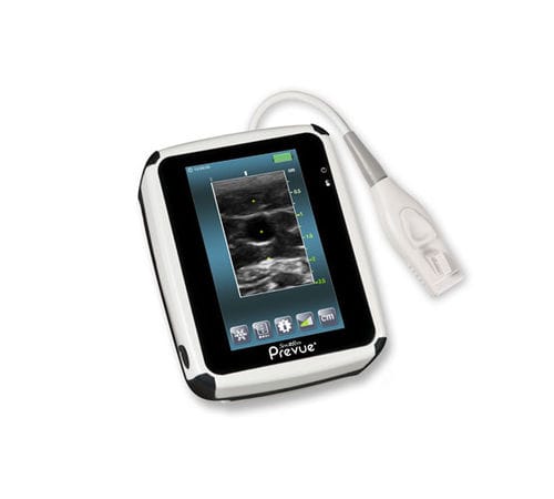 Aparelho de ultrassom de bolso - SITE-RITE PREVUE+® - Bard Access Systems - para anestesia e cuidados intensivos / em preto e branco / com tela sensível ao toque