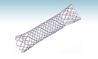 Stent duodenal - HANAROSTENT® NCN - M.I Tech