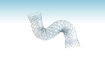 Stent colônico - TwynLay®(NCN) - M.I Tech