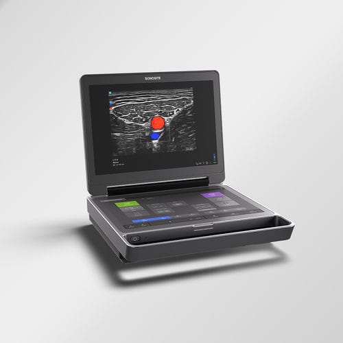 Aparelho de ultrassom portátil - MT - Sonosite - geral / com Doppler colorido / em preto e branco