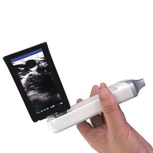 Aparelho de ultrassom de bolso - XProbe - Sonostar Technologies - geral / em preto e branco / com transdutor sem fio