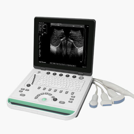 Aparelho de ultrassom portátil - SS-7 - Sonostar Technologies - geral / em preto e branco / com console integrada