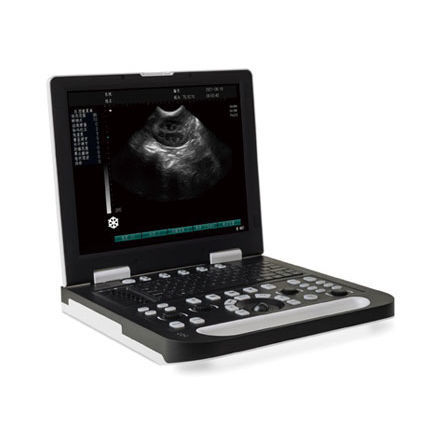 Aparelho de ultrassom portátil - SS-10 - Sonostar Technologies - geral / em preto e branco / 15 polegadas