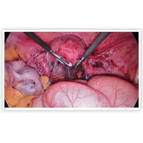 Monitor cirúrgico - CuratOR® EX4342-3D - EIZO GmbH - médico-hospitalar / para sala de cirurgia / para endoscopia