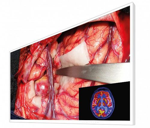 Monitor cirúrgico - CuratOR® EX5542 - EIZO GmbH - médico-hospitalar / com resolução 4K / 55"