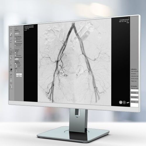 Software de análise - QVA - Pie Medical Imaging - de criação de laudos / de tratamento / de avaliação