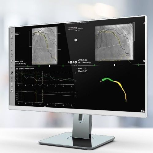 Software de análise - vFFR - Pie Medical Imaging - de visualização 3D / médico-hospitalar / para hospital
