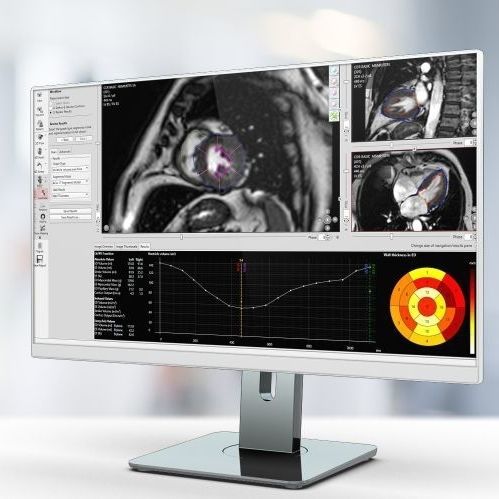 Software de análise - Pie Medical Imaging - de criação de laudos / médico-hospitalar / para RM