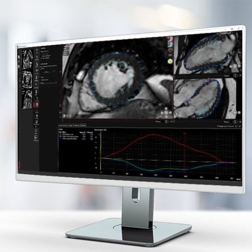 Software médico-hospitalar - MR Strain - Pie Medical Imaging - clínico / para RM / para cardiologia
