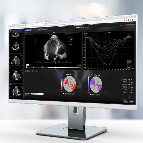 Software de análise - Qardia - Pie Medical Imaging - de criação de laudos / de medição / médico-hospitalar