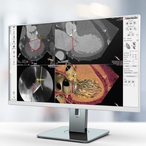 Software de análise - Pie Medical Imaging - de criação de laudos / de visualização / de planejamento