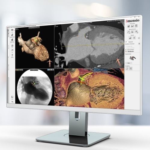 Módulo de software de visualização 3D - Pie Medical Imaging - de diagnóstico / de planejamento / médico-hospitalar