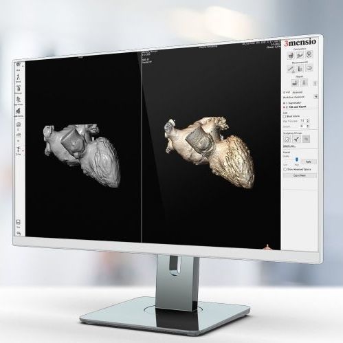 Software de captura - Pie Medical Imaging - de impressão 3D / para TC / para pesquisa