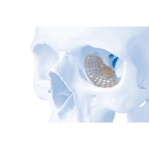 Implante orbitário não absorvível - MatrixORBITAL™ - Depuy Synthes