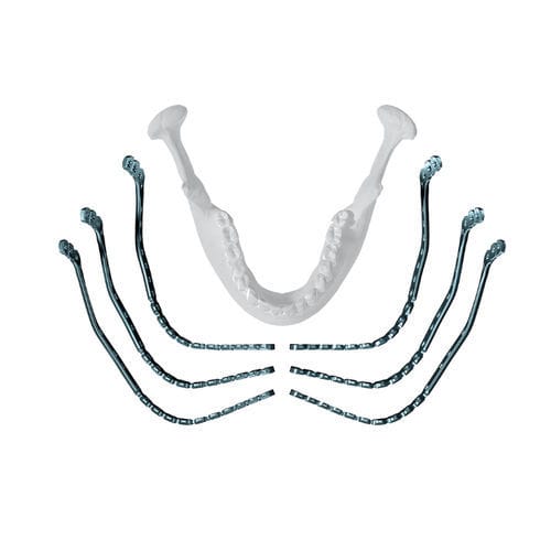 Placa de compressão óssea para mandíbula - MatrixMANDIBLE™  - Depuy Synthes - distal / bloqueada / metálica
