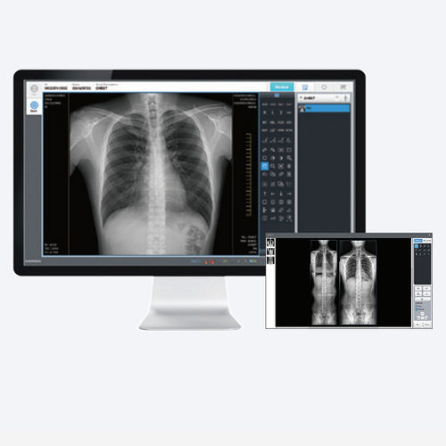 Software de aquisição - EConsole1  - DRTECH - de edição de imagens / para radiologia / de osso
