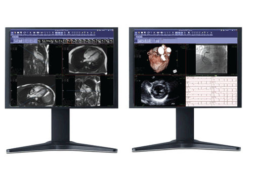Software de visualização 3D - iNtuition REVIEW - TeraRecon - de diagnóstico / para oncologia / para medicina cardiovascular