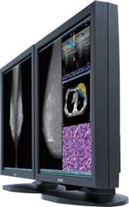 Monitor médico - CCL550i2 - TOTOKU - para mamografia / 21,3" / LCD