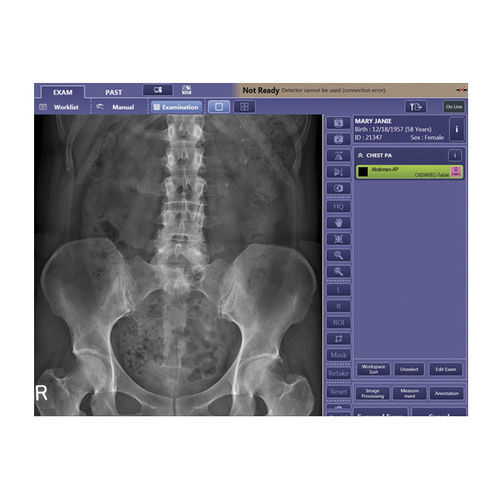 Software de análise de imagens - CXDI  - Canon Medical System U.S.A - de controle / de visualização / de aquisição