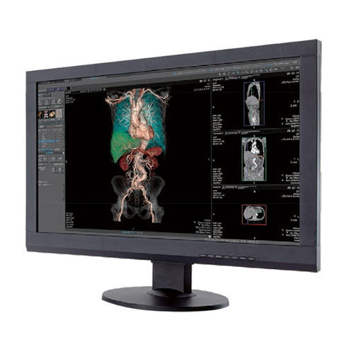 Estação de trabalho informática para exames de imagem - Canon Medical System U.S.A