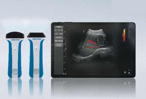 Aparelho de ultrassom de bolso - uREzpocus - Swissray - geral / em preto e branco / com Doppler colorido