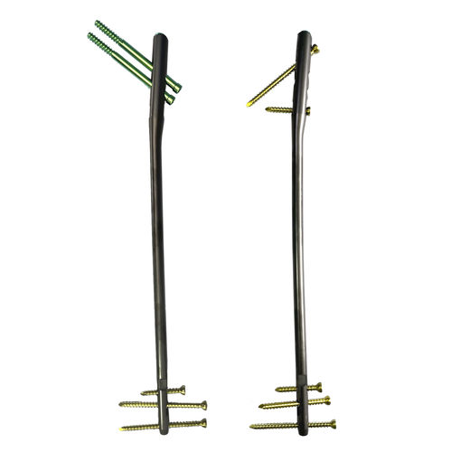 Haste intramedular para fêmur - HJ-EFN - Health-Joy Medical - fixação proximal / fixação distal / em titânio