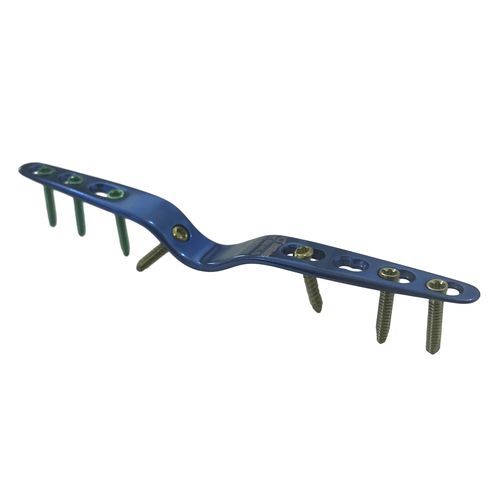 Placa de artrodese para punho - HJ-Small Hand Fusion - Health-Joy Medical - para carpo / para articulação metacarpofalangeana / distal