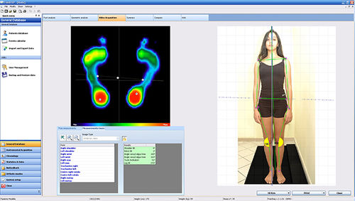 Software de análise - Sensor Medica - de podologia