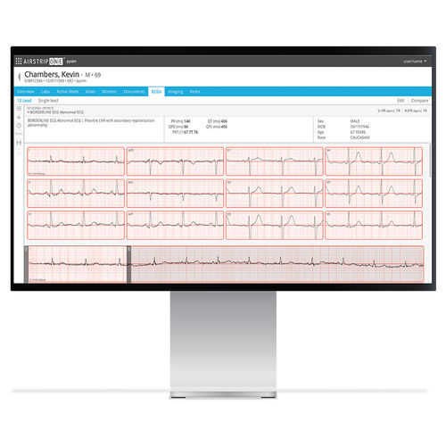 Software de gestão - AirStrip Technologies - de tratamento / de interpretação / médico-hospitalar