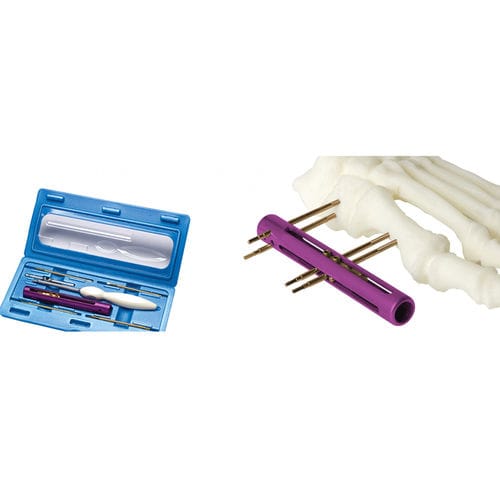 Fixador externo para tarso - SIDEKICK™ - Wright Medical Technology - tubular