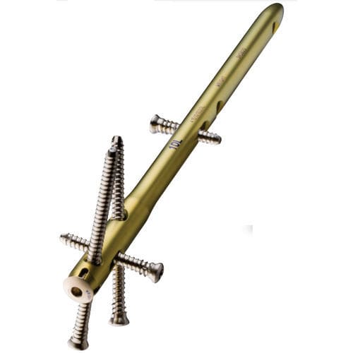 Haste intramedular para tornozelo - VALOR™ - Wright Medical Technology - fixação distal