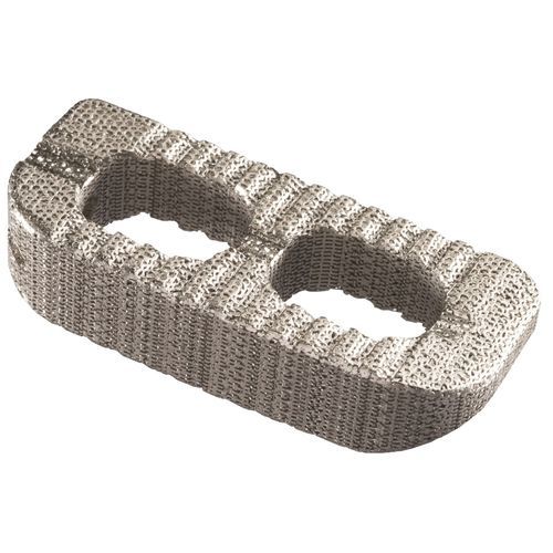 Espaçador intervertebral torácico - IdentiTi™ LIF - Alphatec Spine - via lateral / em titânio