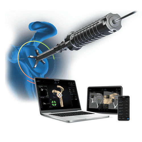 Software de planejamento pré-operatório - VIP - Arthrex - de calibração / para cirurgia ortopédica
