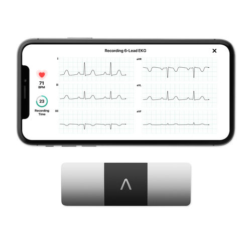 Monitor de paciente de mão - KardiaMobile® 6L - AliveCor - de ECG / para internação domiciliar / para ambiente externo