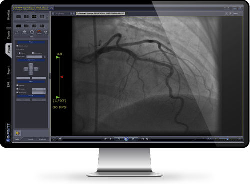 Software de análise - Cath Lab - INFINITT North America - de gestão / médico-hospitalar / de cardiologia