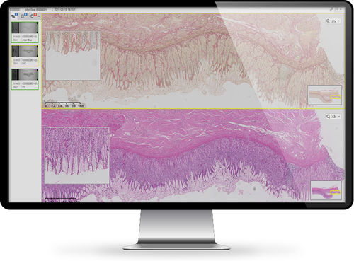 Software de gestão - INFINITT North America - de criação de laudos / de compartilhamento / de segurança
