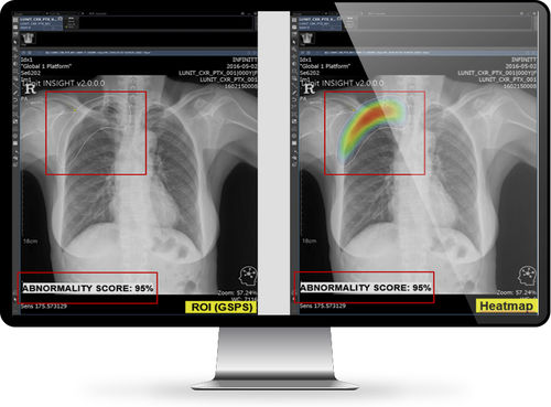 Software de análise de imagens - INFINITT North America - visualizador / médico-hospitalar / para radiologia