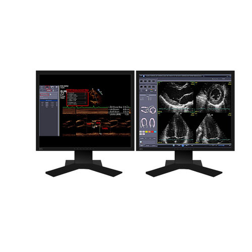 Software para ecocardiografia - INFINITT North America - de criação de laudos / de visualização / de diagnóstico