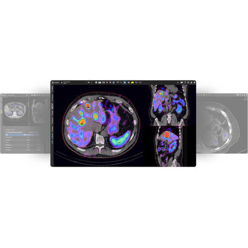 Software de criação de laudos - MIM SurePlan™ MRT - MIM Software - de monitorização de dose de radiação / de anatomia / para medicina nuclear