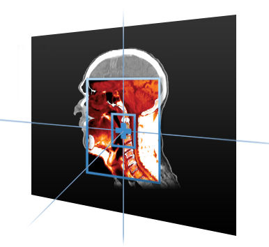 Software de visualização - MIM Maestro® - MIM Software - de planejamento / de tratamento / de contorno