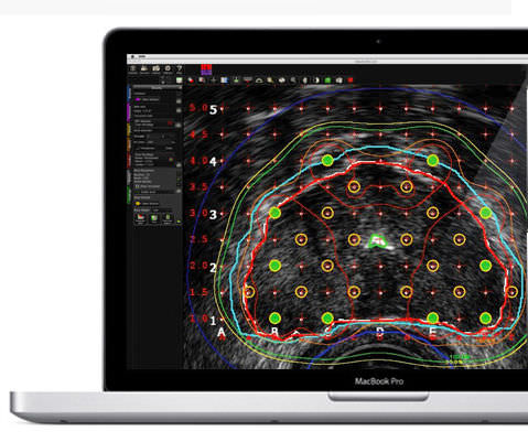 Software de análise - MIM Symphony Dx™ - MIM Software - de gestão / de criação de laudos / de visualização