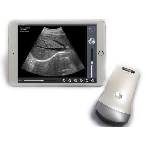 Aparelho de ultrassom de bolso - SS-1, SS-2 - SonopTek - geral / com transdutor sem fio