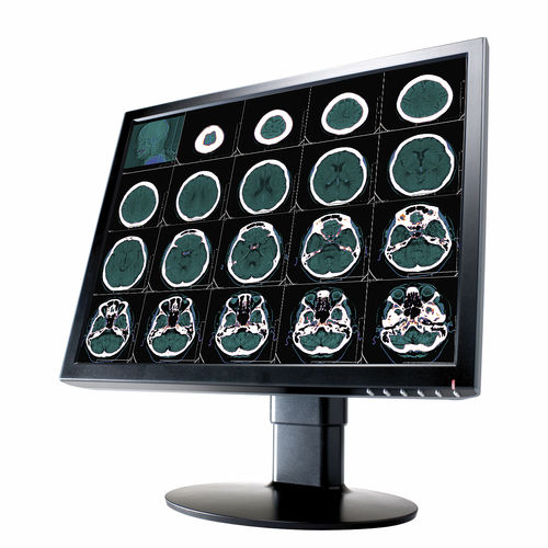 Monitor médico - 2 MP | CL2000 - Richardson Electronics - Healthcare - de diagnóstico / para radiologia / 20,1"