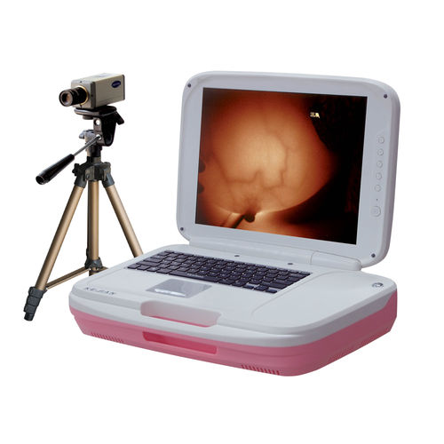 Videocolposcópio - AD-1202 - Xuzhou Kejian Hi-tech - portátil