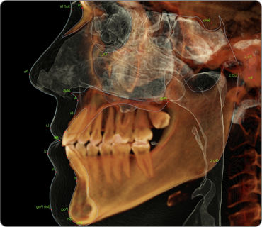 Módulo de software de análise cefalométrica - Anatomage - de simulação 3D / para imagiologia dentária / ortodôntico